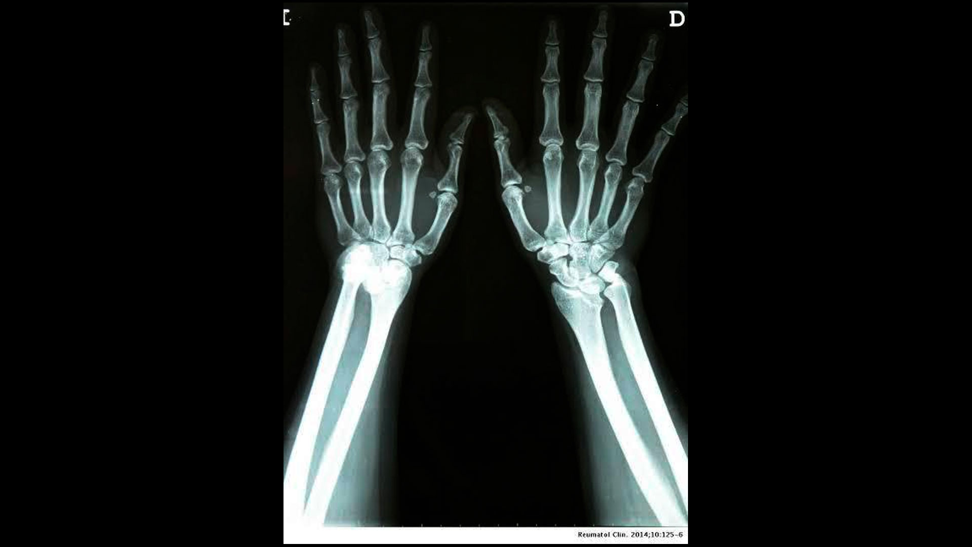 Rayos X / Radiografías Trauma Clinic